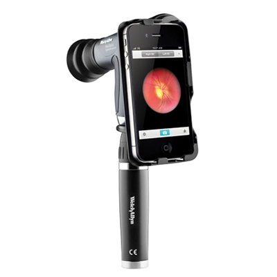 Welch Allyn iExaminer Adapter for Panoptic Ophthalmoscope, Iphone 4 and 4S