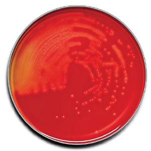 BD BBL Trypticase Soy Agar with 5% Sheep Blood Plate, 100/Pack
