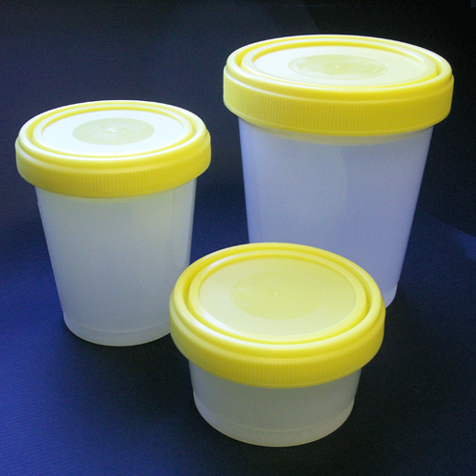 Globe Scientific 500 ml PP Large Capacity Histology Containers w/ Separate Yellow Screw Cap, 100/Case
