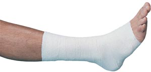 BSN Medical Gelocast® Unna Boot, 4" x 10 yds