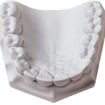 Microstone: Premium Dental Stone, White