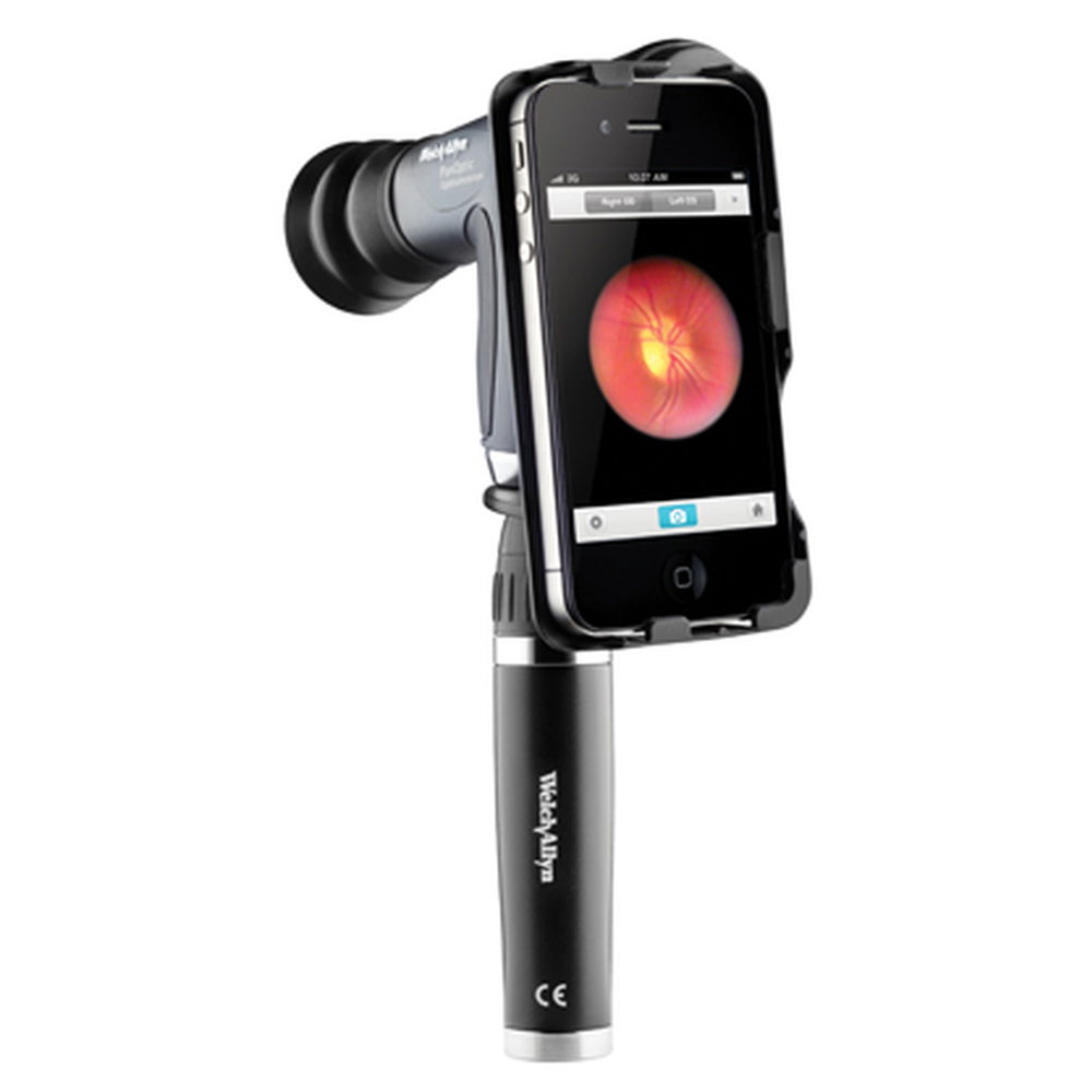 Welch Allyn iExaminer PanOptic Ophthalmoscope Adapter for iPhone 6 and 6S Cameras