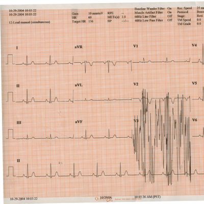 Cardinal Health Paper, EKG, 8.495" x 183 ft, 18416-002, 20 pd/cs