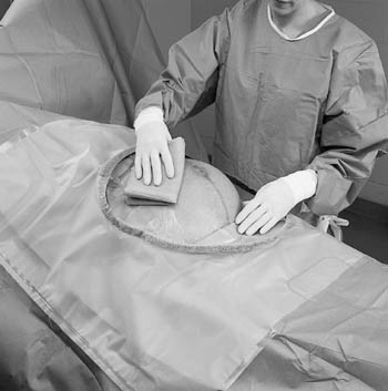 [2057] 3M™ Steri-Drape™ Cesarean-Section Sheets with Incise Pouch, 35" x 30"