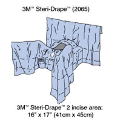 [2065] 3M™ General Steri-Drape™ Abdominal Perineal Drape with Incise Film, 160", Lithotomy Position