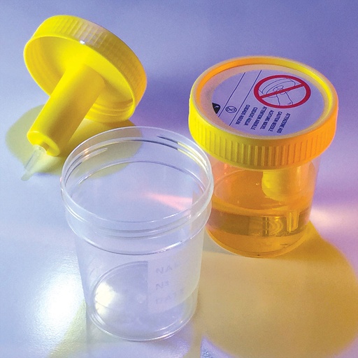 [3856L] Globe Scientific TransferTop 120 ml Sterile Urine Collection Cups w/ Integrated Transfer Device, 300/Case
